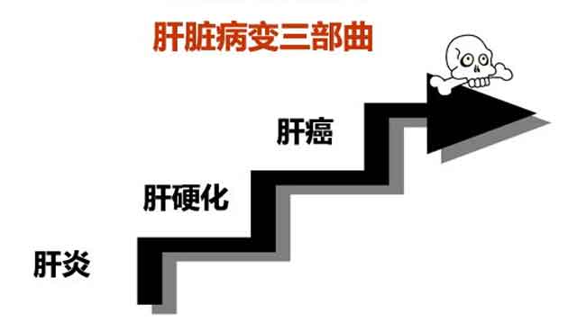 郑州肝硬化医院哪家好?河南治疗肝硬化那个医院好